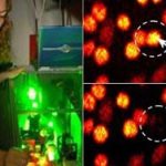 Dao laser diệt từng tế bào ung thư