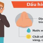 7 dấu hiệu cảnh báo bạn bị viêm xoang