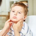 Đau họng nổi hạch ở cổ do đâu? Tình trạng này có nguy hiểm không?