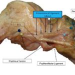 Phát hiện bộ phận mới ở đầu gối người