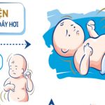 Đầy hơi ở trẻ em và sai lầm cần tránh