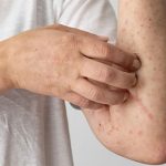 Dấu hiệu cảnh báo nhiễm ký sinh trùng