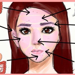 Đoán bệnh qua vị trí mụn mọc trên mặt
