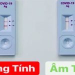 Test nhanh vạch T đậm hay mờ có thể hiện Covid-19 nặng hay nhẹ?