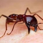Dùng kiến khâu vết thương gây tranh cãi trong lịch sử y khoa