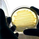 Vi khuẩn E.coli có thể sản xuất diezel