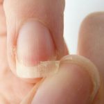 Móng tay dễ gãy: 6 nguyên nhân thường gặp và cách khắc phục nhanh chóng