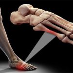 5 điều mọi người hay hiểu lầm về xương