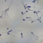 Hoàn tất giải mã bộ gene tinh trùng người