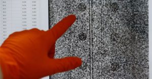 Phát hiện virus bí ẩn tái tổ hợp từ SARS-CoV-2