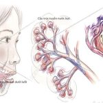 Dấu hiệu nhận biết sớm ung thư tuyến nước bọt