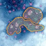 Tìm được lời giải vì sao H5N1 gây tử vong cao ở người