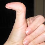 Những điều ít biết về người có ngón tay cái bẻ ngược