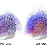 Lần đầu tiên trên thế giới: phục hồi cho bệnh nhân sống thực vật