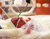 Suy hô hấp ở trẻ sơ sinh