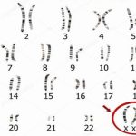 Hội chứng Klinefelter – Những người đàn ông mang gene nữ