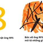 Bệnh não kỳ lạ giúp khoa học hiểu hơn về cách não bộ tiếp nhận thông tin