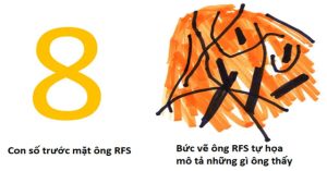 Bệnh não kỳ lạ giúp khoa học hiểu hơn về cách não bộ tiếp nhận thông tin