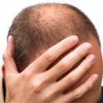 Đàn ông sợ hói đầu hơn bị “bất lực”