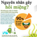 Hôi miệng và sai lầm trong cách chữa