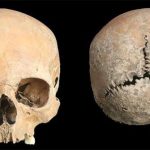 Ám ảnh hộp sọ thiếu nữ cổ đại bị cắt mũi, cắt môi, gọt da đầu