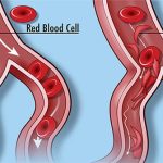 Cấy virus HIV vào tủy để cứu những bệnh nhân chết dần chết mòn vì nghẹt thở