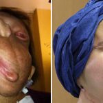 Người phụ nữ mang gương mặt quỷ trở nên xinh đẹp đến bất ngờ sau 3 năm