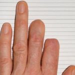 Bé gái 7 tuổi có khả năng tự mọc lại ngón tay không khác gì người Namek