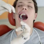 Những lầm tưởng về chiếc răng khôn