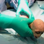 Khỉ sơ sinh có gương mặt giống Chúa tể Hắc ám Voldemort