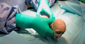 Khỉ sơ sinh có gương mặt giống Chúa tể Hắc ám Voldemort