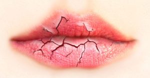 Cách xử lý bệnh thường gặp trong mùa lạnh khiến miệng lúc nào cũng khô