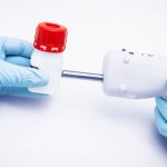 Phát hiện dấu hiệu ung thư nhờ tia laser Raman