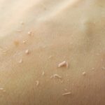 Vì sao ngày nào cũng tắm sạch rồi mà kì nhẹ thôi cũng ra ghét?