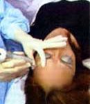 Chữa mụn và làm đẹp bằng laser