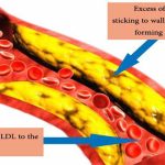 Chỉ số LDL cholesterol trong máu là gì?
