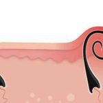 Những hậu quả đáng lo ngại khi nhổ lông nách bằng nhíp