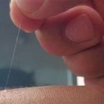 Tại sao một số lông trên cơ thể bạn có thể mọc dài tới mức vô lý?