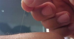 Tại sao một số lông trên cơ thể bạn có thể mọc dài tới mức vô lý?