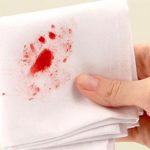 3 dấu hiệu mà nhiều người thường nhầm lẫn giữa bệnh ung thư ruột và bệnh trĩ