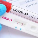 Các nhà khoa học phát triển mồi nhử Covid-19 khỏi tế bào khỏe mạnh
