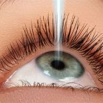 Những nguyên nhân gây tái cận sau mổ mắt