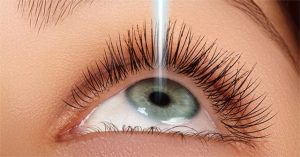 Những nguyên nhân gây tái cận sau mổ mắt