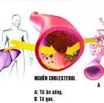 Rối loạn mỡ máu điều trị có thể không dùng thuốc