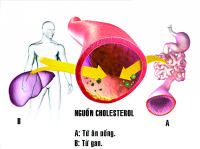 Rối loạn mỡ máu điều trị có thể không dùng thuốc