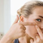 Sẽ có vaccine phòng mụn trứng cá