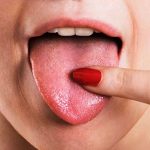 Nguyên nhân gây ra vị chua trong miệng là gì?