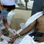 Bỏng đường hô hấp nguy hiểm như thế nào?