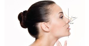 Tại sao nâng mũi, độn cằm bằng filler có thể gây biến chứng?