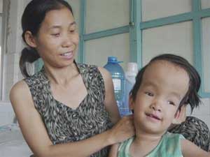 Não úng thủy ở trẻ em: Điều trị được nếu tận dụng “thời gian vàng”